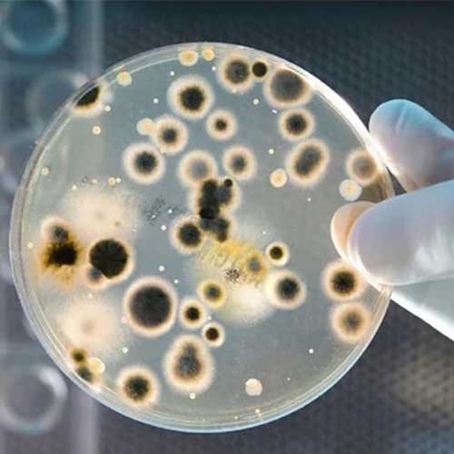 Bacteria Culture 